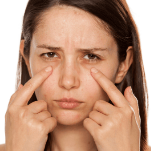 thermage eyes  singapore